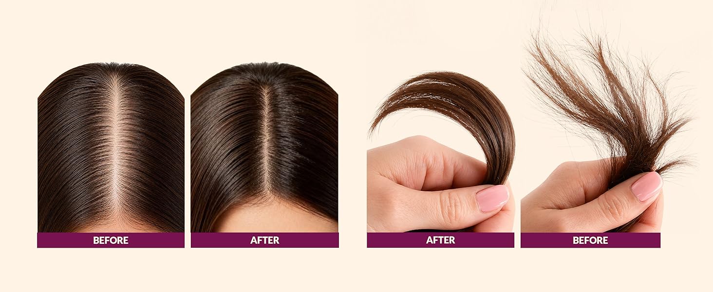 ONION ROSEMARY BIOTIN KIT