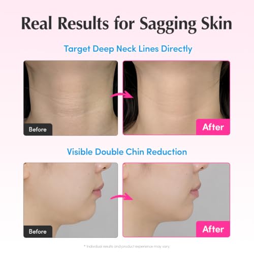 Décolleté | Korean Skin Care