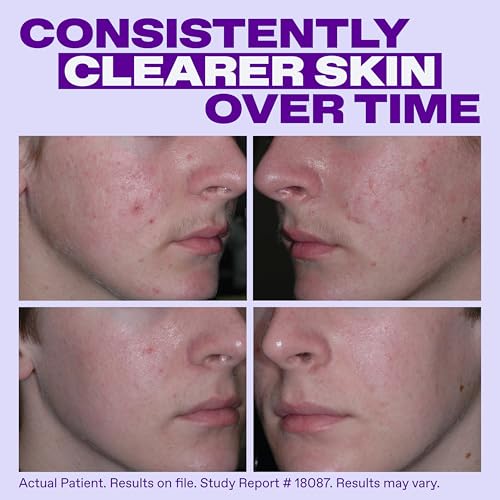 Clears & Prevents Breakouts