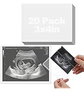 12pcs 1000ml Leakpoof Kids Vomit Bags Disposable - Portable & Sealed, Nausea Relief Throw up Barf...