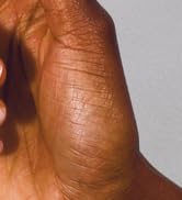 weak nails treatment solution damaged repair best nail polish