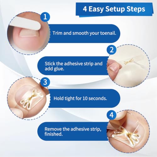 Complete Ingrown Toenail Removal Kit