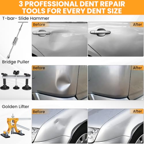 Professional Paintless Dent Removal Kit