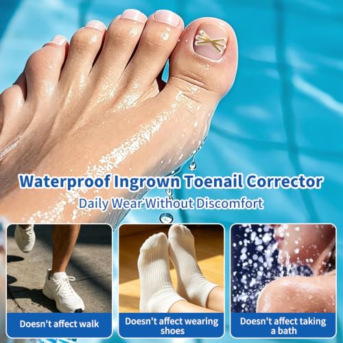 Professional At-Home Ingrown Toenail Treatment for Men Wome