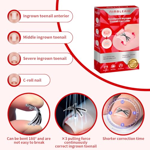 Ingrown Toenail Removal Kit