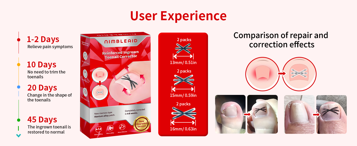 Ingrown Toenail Corrector with Upgraded 6-Angle Shape