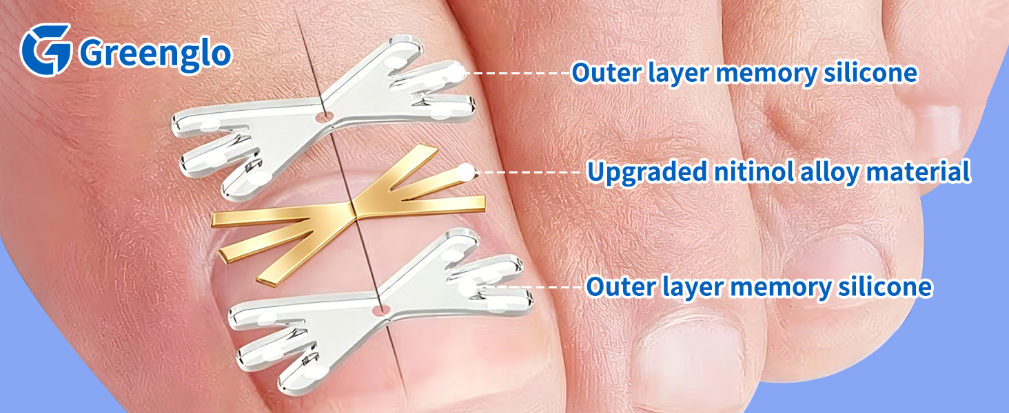 Golden Titanium Ingrown Toenail Corrector