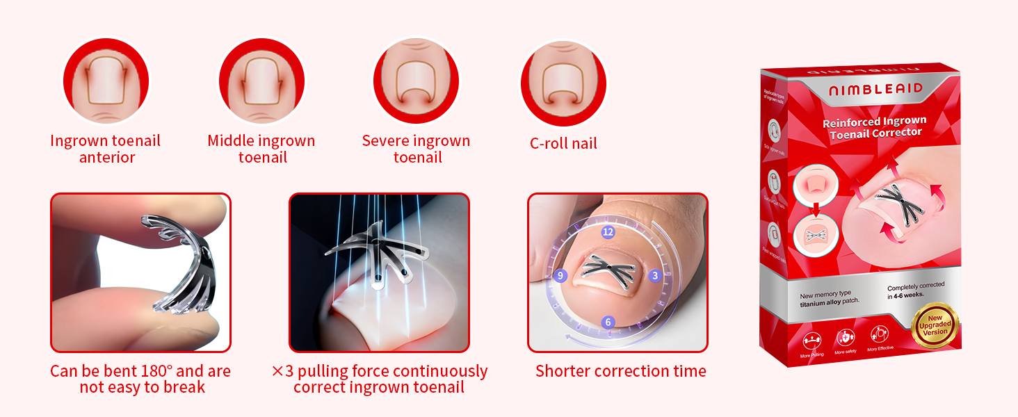 Ingrown Toenail Corrector with Upgraded 6-Angle Shape