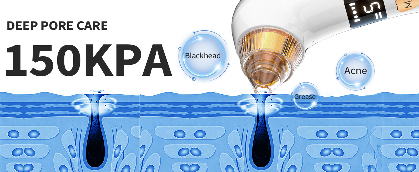 Blackhead remover tools