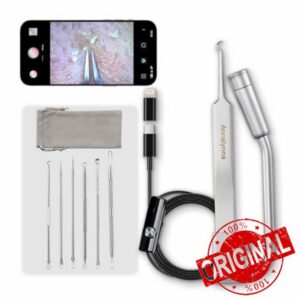 Luma 1 Visual Blackhead Tweezers with Camera，See What You've Been Missing                                                          1080P & 20x Mag. 6-in-1 Professional Comedone Extraction Kit
