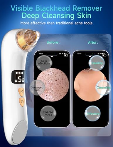 5 Suction Levels