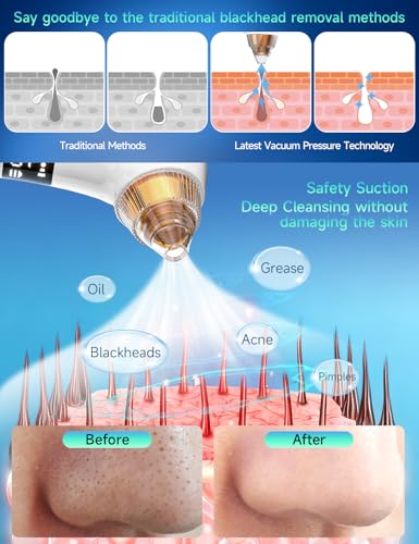 6 Probes Heating Facial Deep Cleansing
